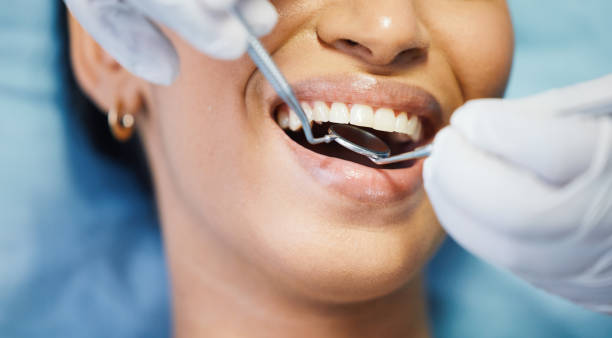 Best Dental Abscess Treatment in Braddock Heights, MD