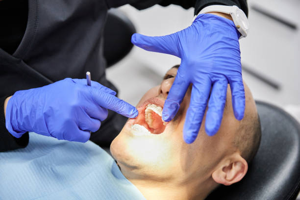 Best Lost Filling or Crown Replacement in Braddock Heights, MD